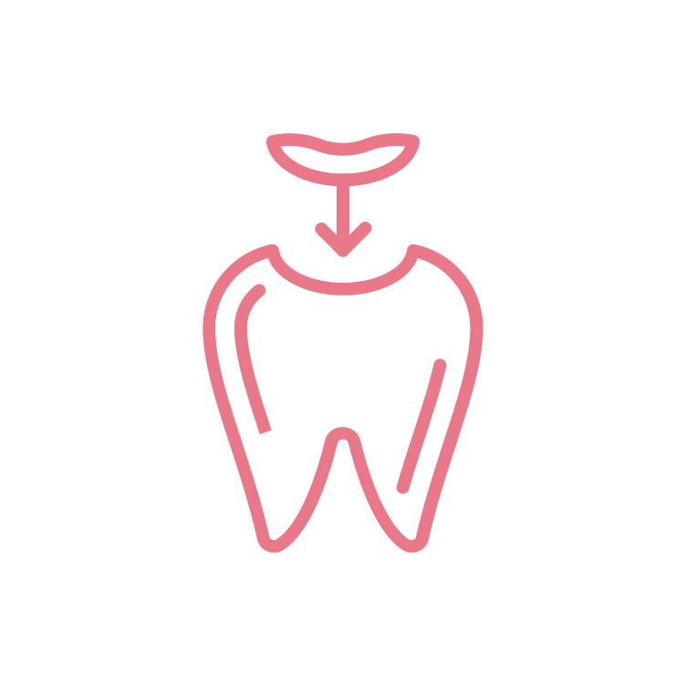 Fillings Fillings