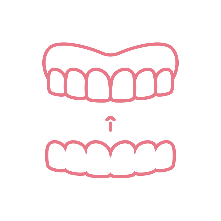 Invisalign Invisalign